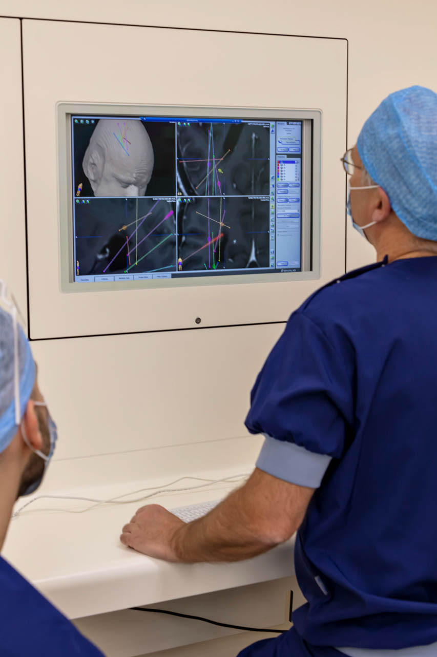 MRI-scan
